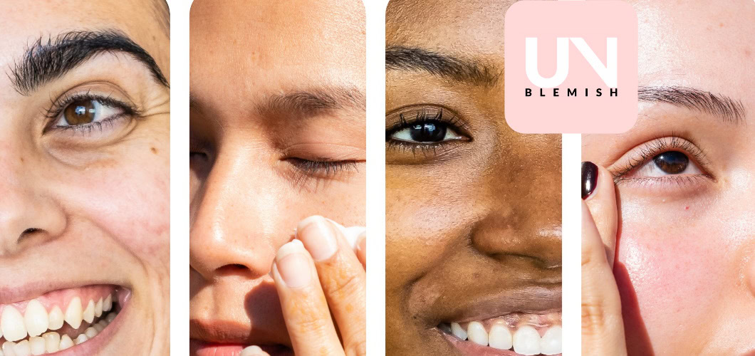 What is my skin type