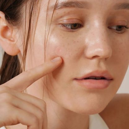 ISNTREE Onion Newpair Spot 12 Patches