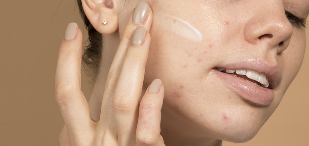 Korean Skincare & Accutane