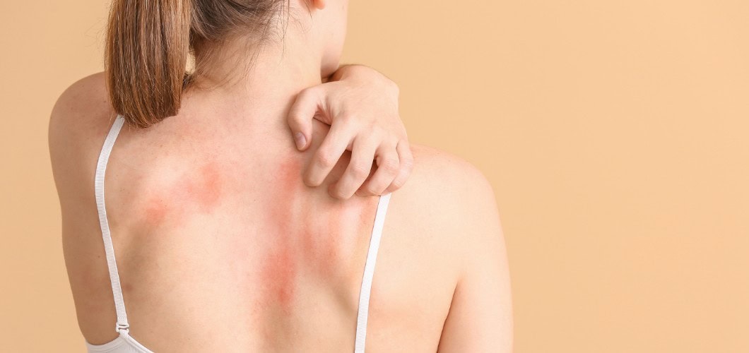 Repairing Your Body Barrier